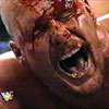 WrestleMania 13: Bloody Austin